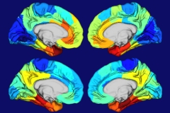 Why Alzheimer’s Disease Damages Certain Parts of the Brain– New Genetic Clues