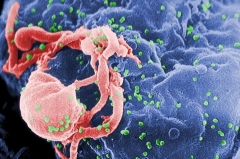 Why Comorbidities Persist: HIV Infection Leaves a “Memory” in Cells