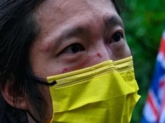 Britain protects determined reaction to Chinese diplomats roughing up Hong Kong protester in Manchester consulate