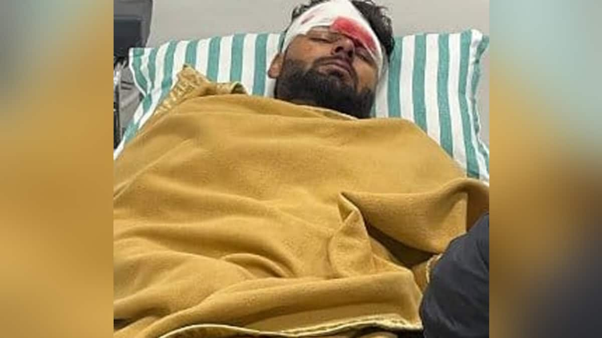 Rishabh Pant Accident: Star Cricketer’s Brain, Spinal Cord MRI Normal, Undergoes Plastic Surgery