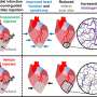 Researchers discover method to recover scars left by cardiovascular disease