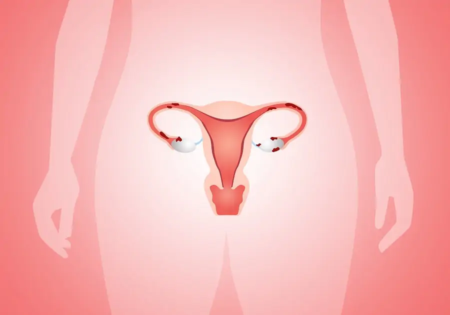 Transplante uterino avança no cenário mundial com sucesso registrado nos EUA