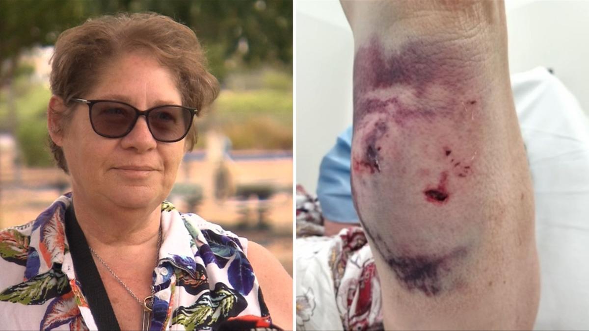 Adelaide grandma whipped by canine in regional park