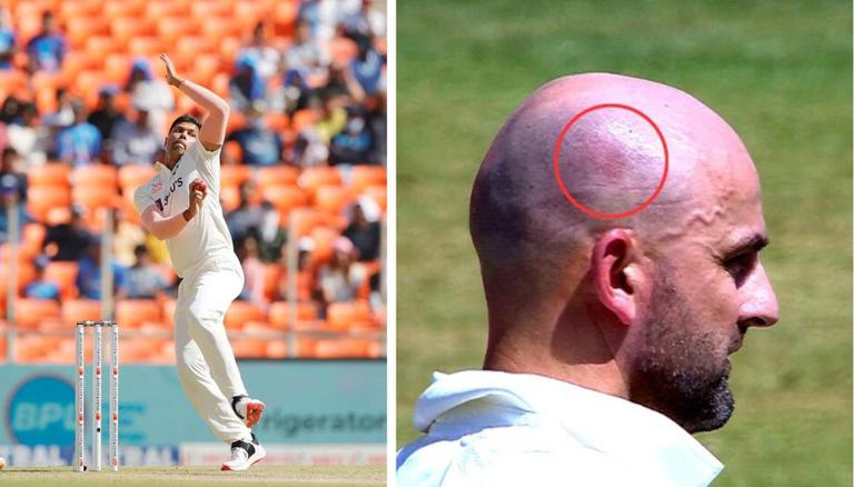 IND vs AUS: Umesh Yadav leaves a mark on Nathan Lyon’s head with relentless shipment|Cricket News