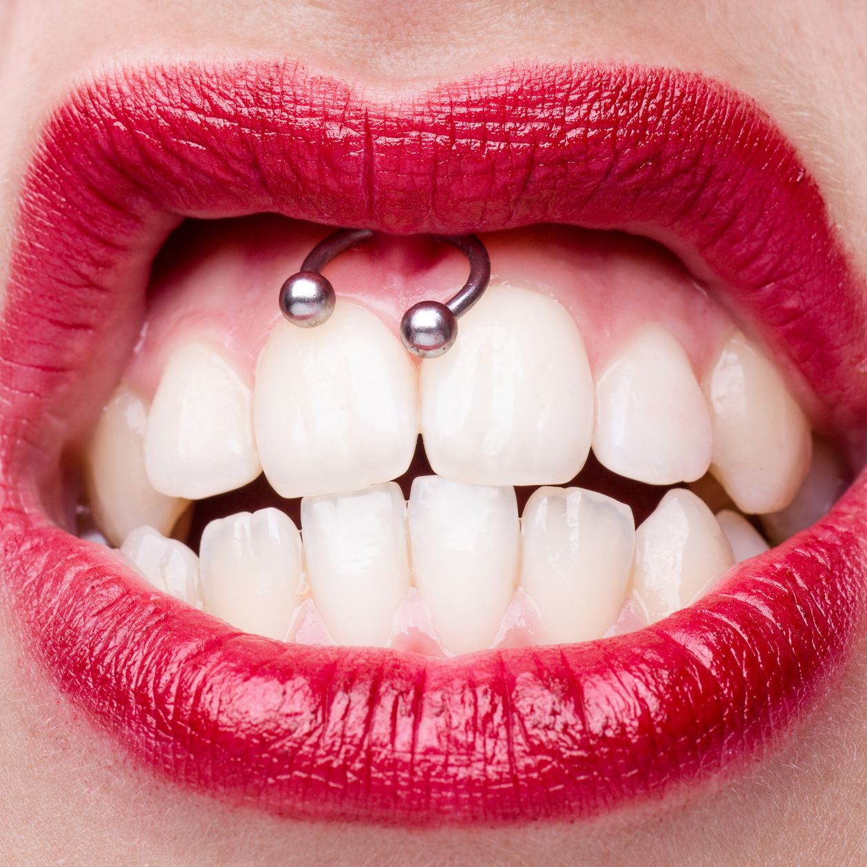 El piercing Smiley: ¿ duele realmente tanto como dicen?