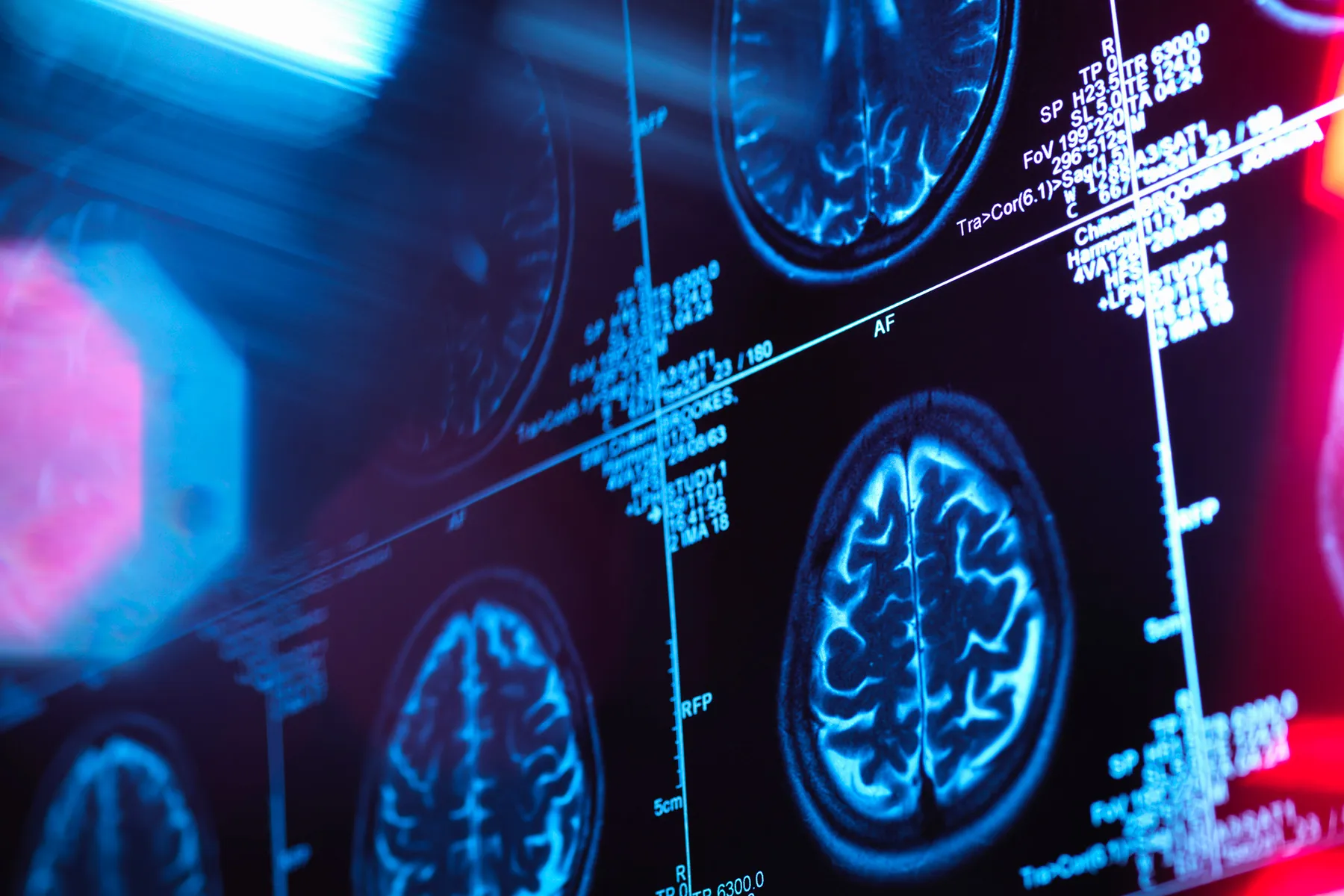 Typical Chemical Linked to Parkinson’s Disease