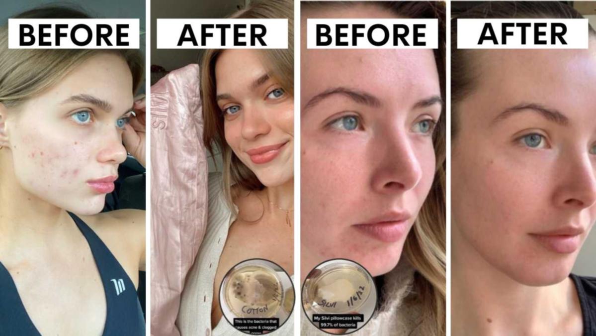 Viral TikTok video with 10m views exposes jaw-dropping trick behind Silvi silk pillowcase hailed for changing skin