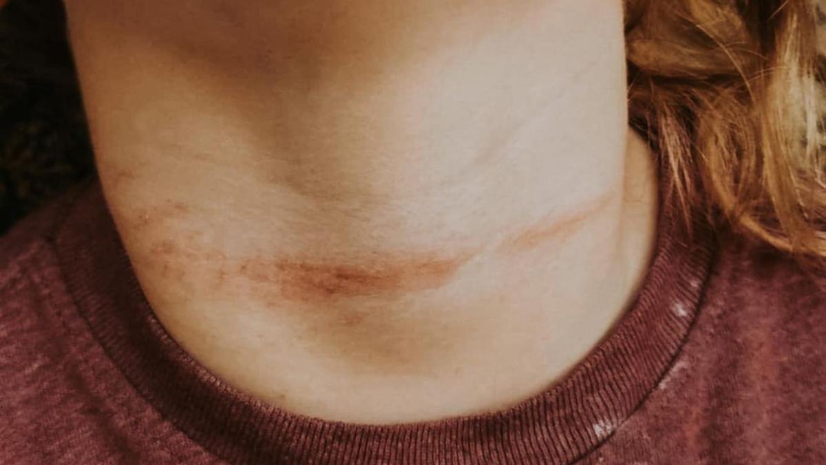 Blind cable threat: Photo of child’s neck leaves mum ‘ill to her stomach’ as cautioning provided