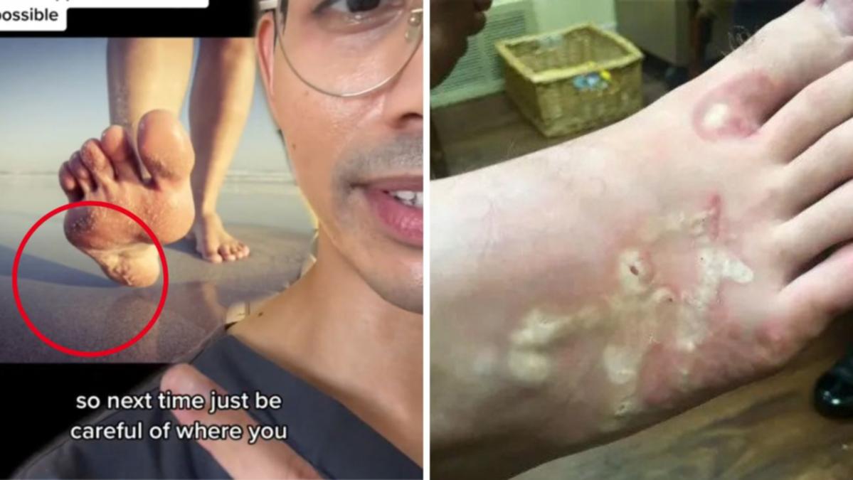 TikTok medical professional Samuel Choudhury shares swallow churning factor you need to never ever sit or push a beach without a towel