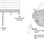 How swelling impacts brain advancement