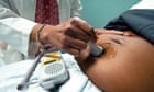 Test authorized to spot preeclampsia, leading reason for United States maternal deaths