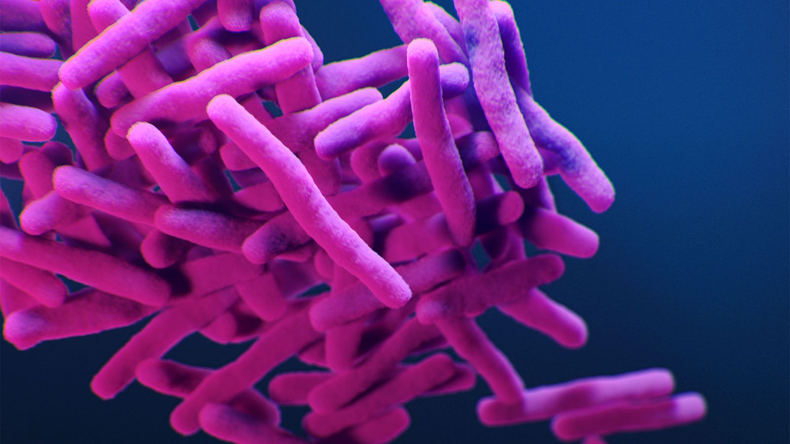 CDC Details Multidrug-Resistant TB Outbreak in an Unlikely Spot