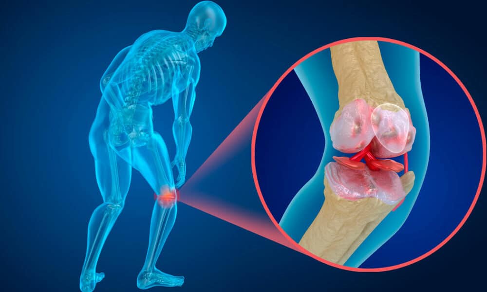 Un 23% de mujeres mayores de 50 años sufre osteoporosis, según la SEEN