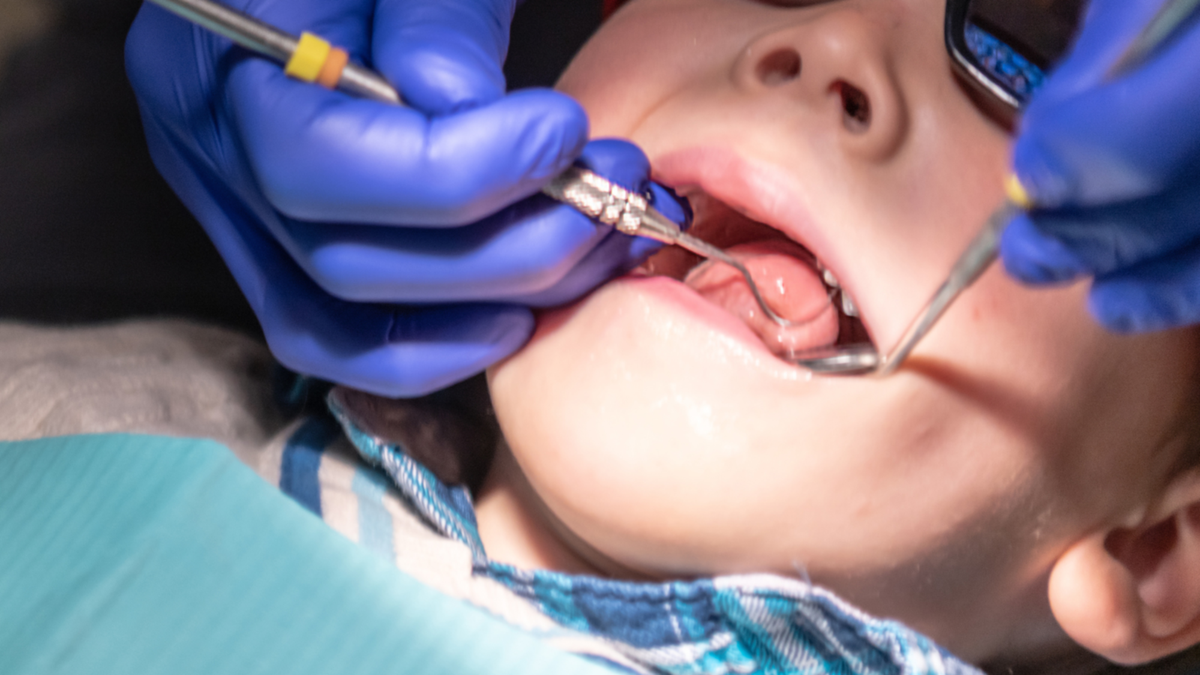 Dental practitioners exposes how two-year-old bottle-fed soda from birth lost all 20 teeth