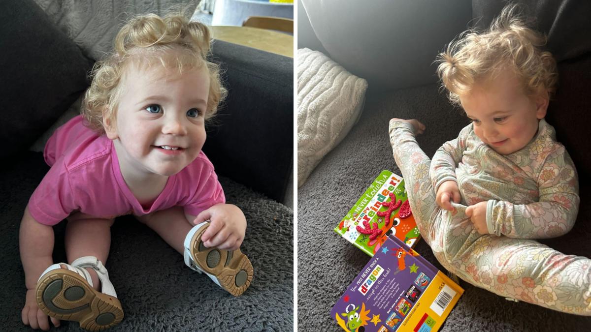 Adelaide young child with uncommon hereditary condition that makes her ‘ultra-flexible’