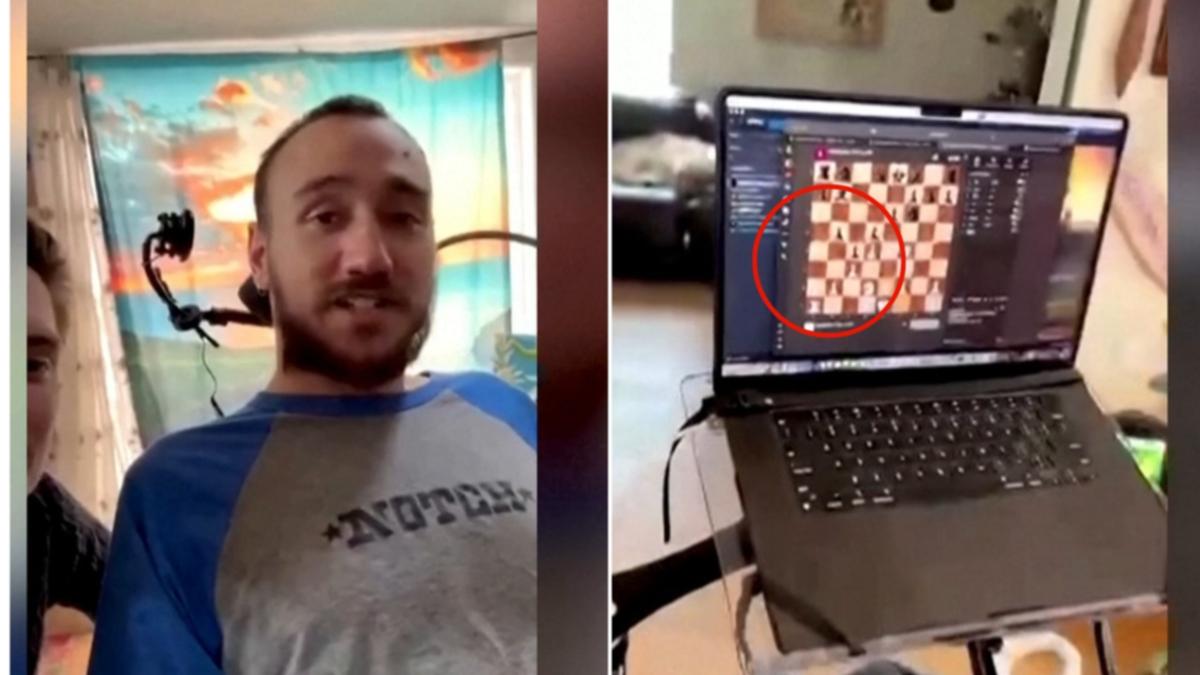 Guy plays online chess utilizing his mind with chip implant from Elon Musk’s Neuralink