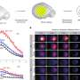 Researchers discover sleep might unclear brain contaminants