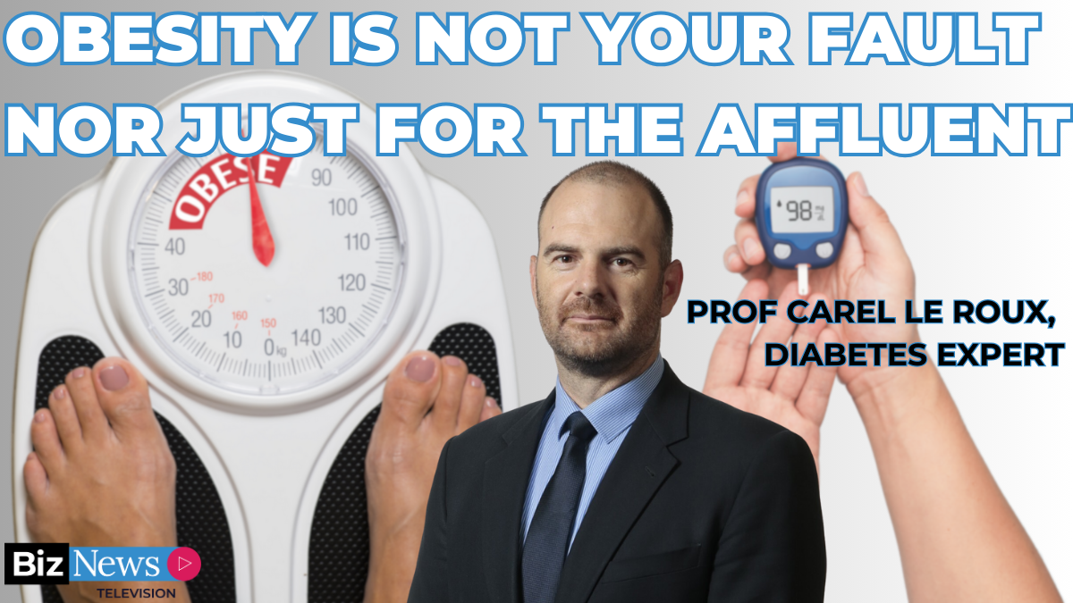 Weight problems is not your fault nor simply for the upscale– Prof Carel le Roux, World-leading SA Diabetes specialist