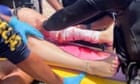 Solo shark bites 2 and reaches 2 others at Texas beach