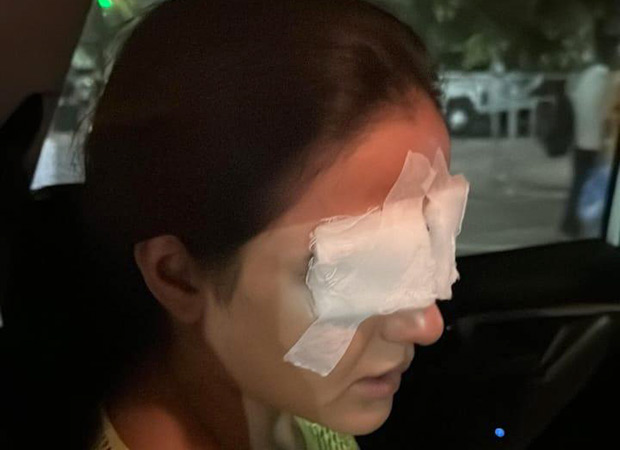 Jasmin Bhasin fights corneal damage after lens incident, leaves her in discomfort