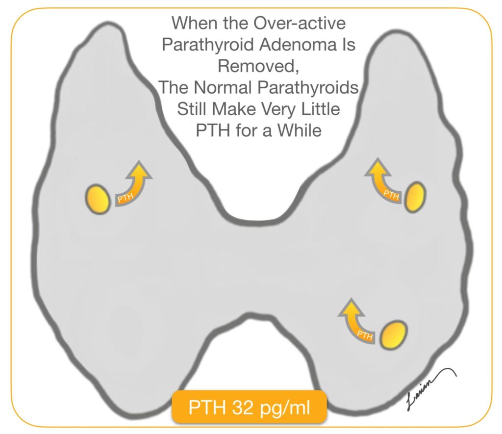 Early Parathyroidectomy No Boon for Preventing Depression