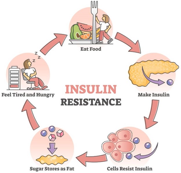 Insulin resistance is connected to over 30 illness– and to sudden death in females, discovers UK research study