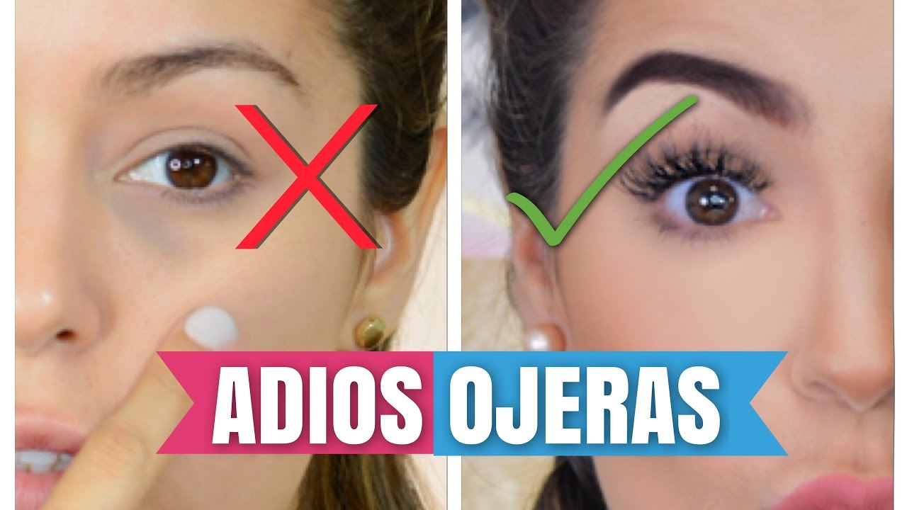 Adiós ojeras: este es el secreto para aclarar la piel y lograr una mirada más luminosa, según un dermatólogo