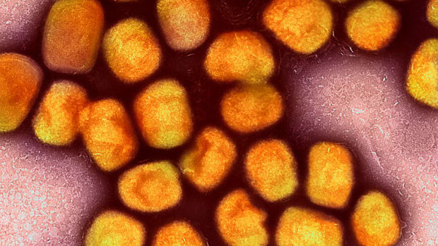 Minnesota sees rise in Norovirus outbreaks. What is it, symptoms, prevention, and treatment