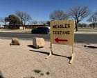 As Texas’s measles outbreak slows, officials warn of rise in other states