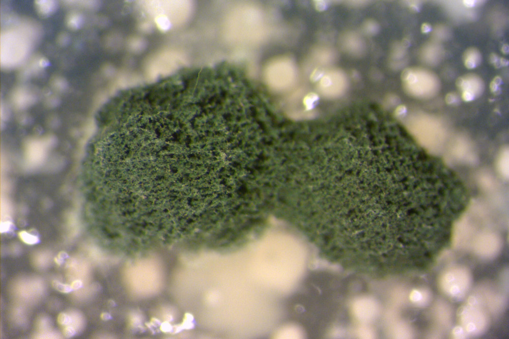 A fungus that can ‘eat you from the inside out’ could spread as the world heats up