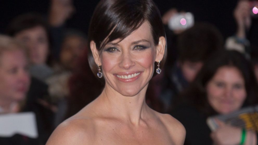 Evangeline Lilly shares pictures of gruesome injuries she sustained after fainting