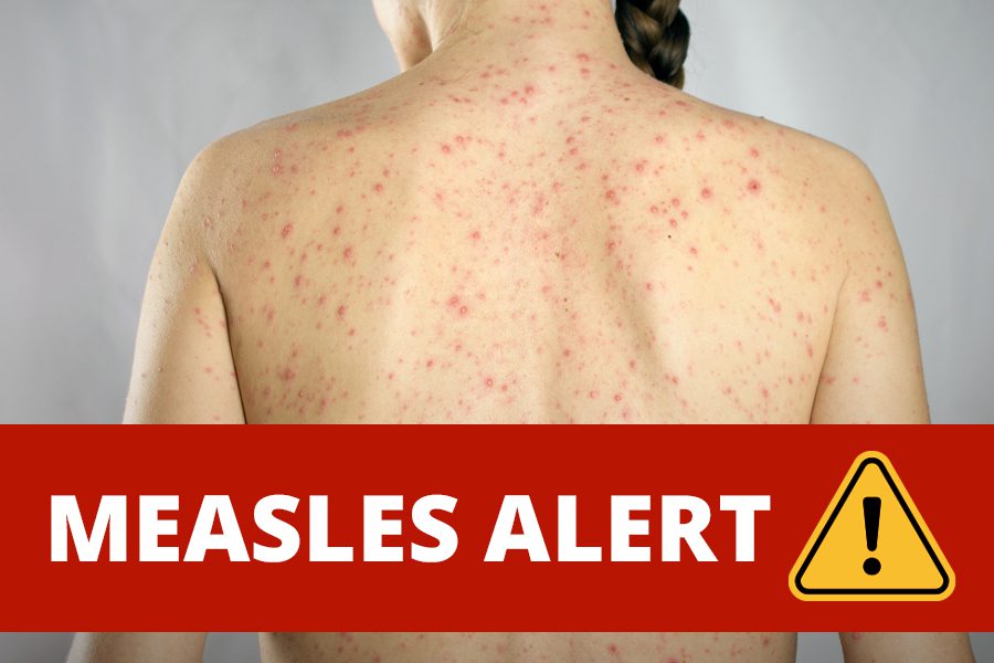 Measles alert for NT as infected tourist visits Darwin and Alice Springs Airport, Litchfield National Park