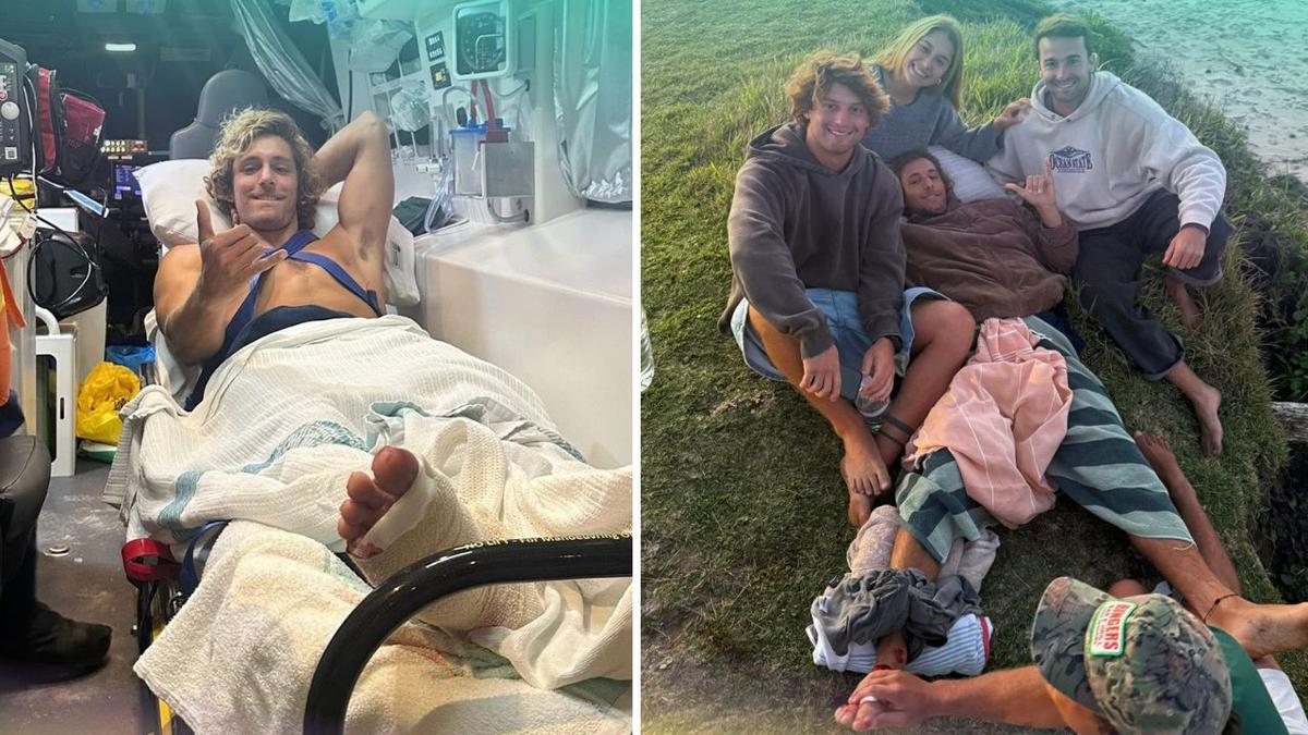 Uruguay national attacked by shark while surfing in NSW says he feels lucky