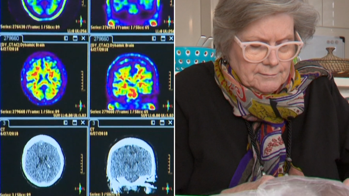 Australian dementia patient backs World Health Organisation recommendations on how to halve cases