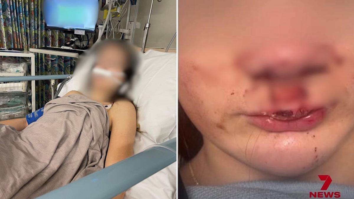 Mum reveals long recovery for young daughter following alleged attack by fellow teens in Robina