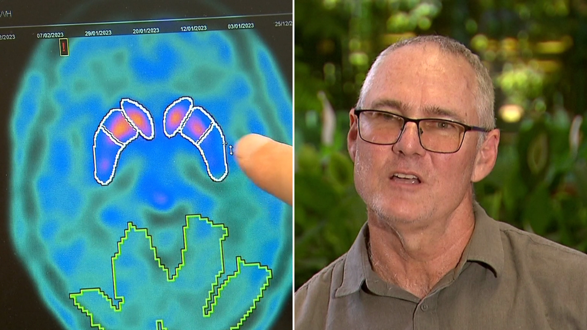 ‘It felt like a life sentence’: New hope for Parkinson’s sufferers in Australian-first trial